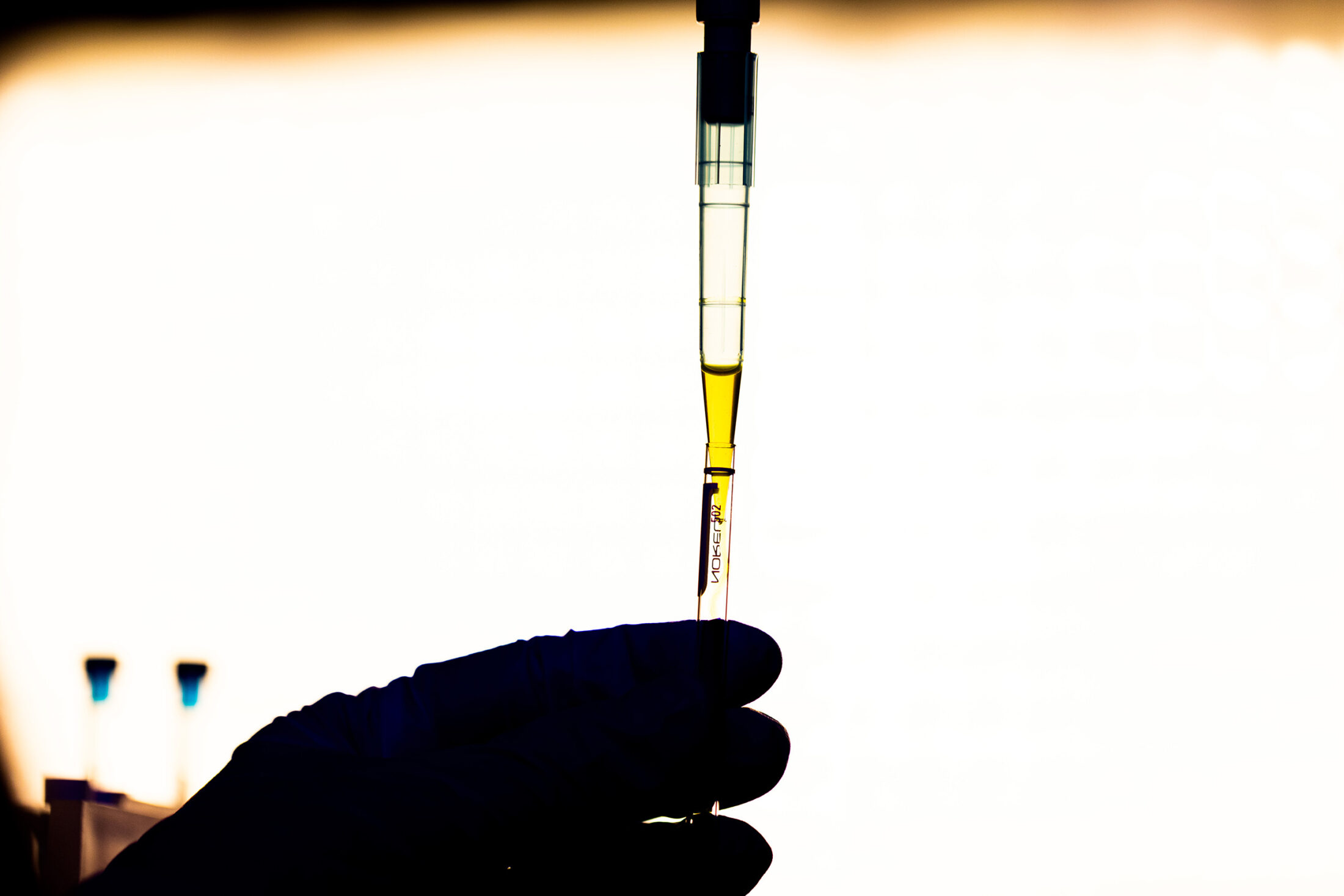 A pipette drops yellow liquid into a container held by a gloved hand in shadow.
