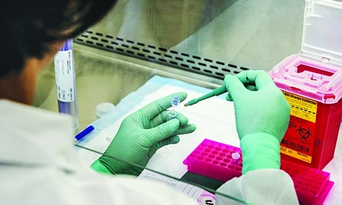 researcher testing virus samples